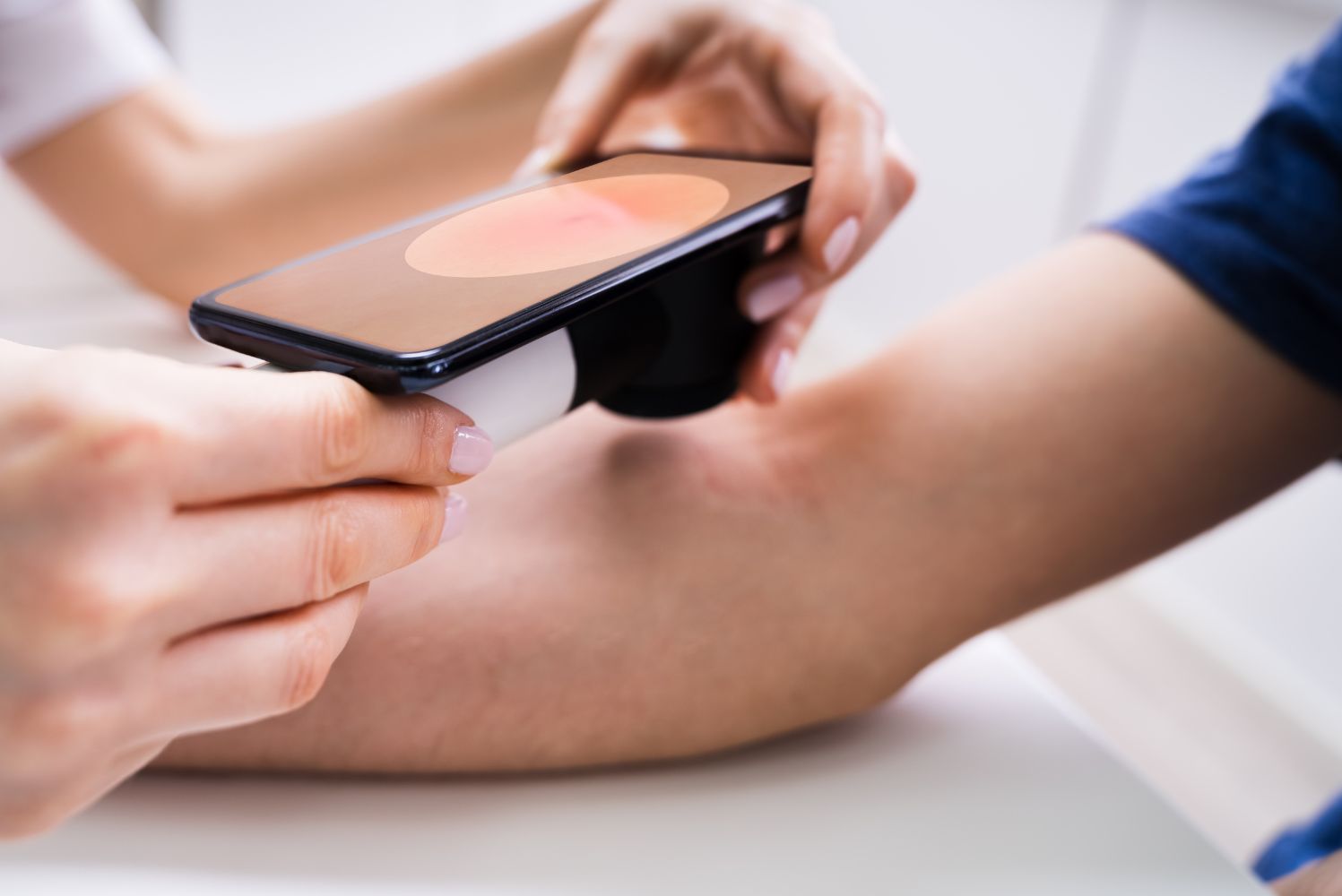 Google Lens transforme votre téléphone en « dermato » !